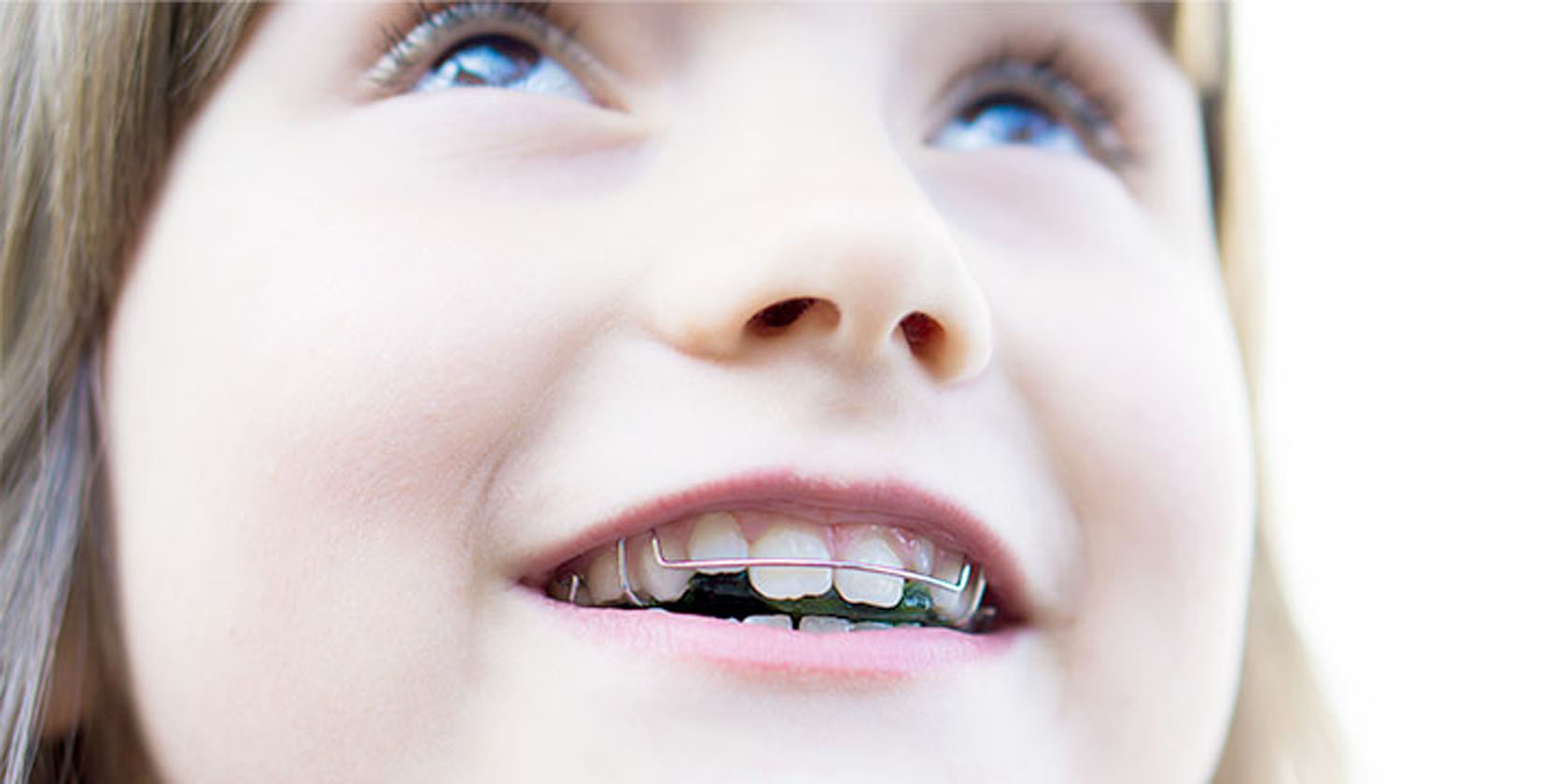 小児矯正歯科イメージ